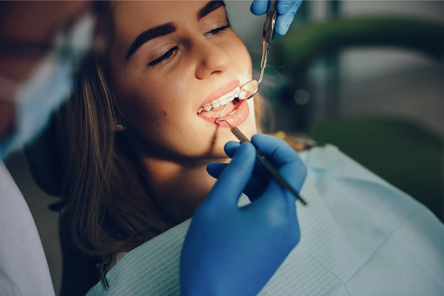 Everything You Need to Know About Braces